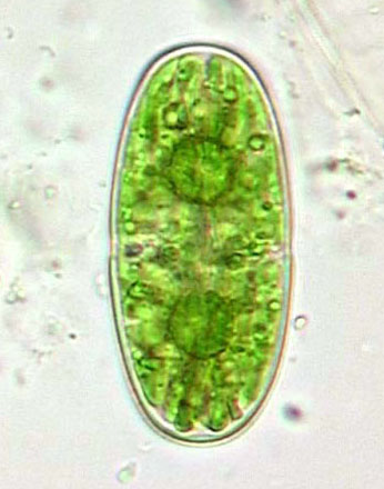 Actinotaenium silvae-nigrae